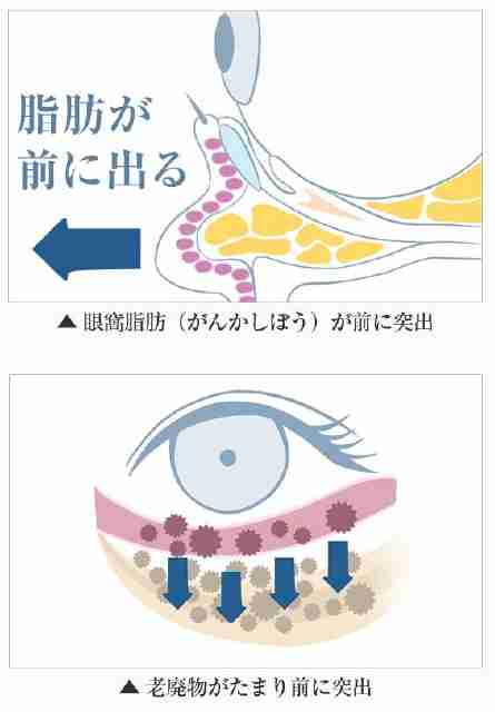 アイキララ　ハリ不足