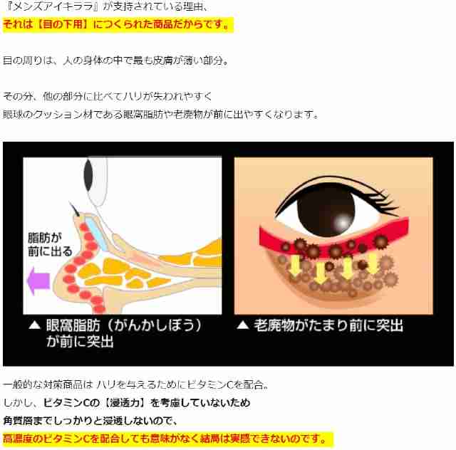 メンズアイキララ